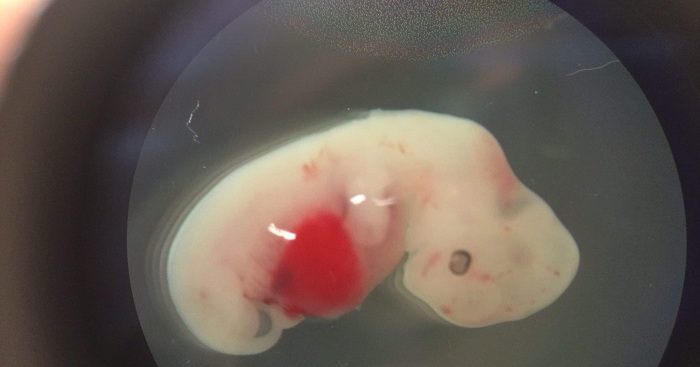 First human-pig embryos made, then destroyed